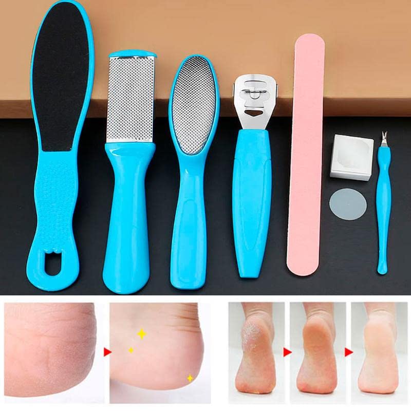Professional 6-Piece Home Pedicure Kit - Callus Remover, Foot Corn Remover, and Nail File - Effectively Removes Hard, Cracked, and Dead Skin Cells for Soft and Smooth Feet