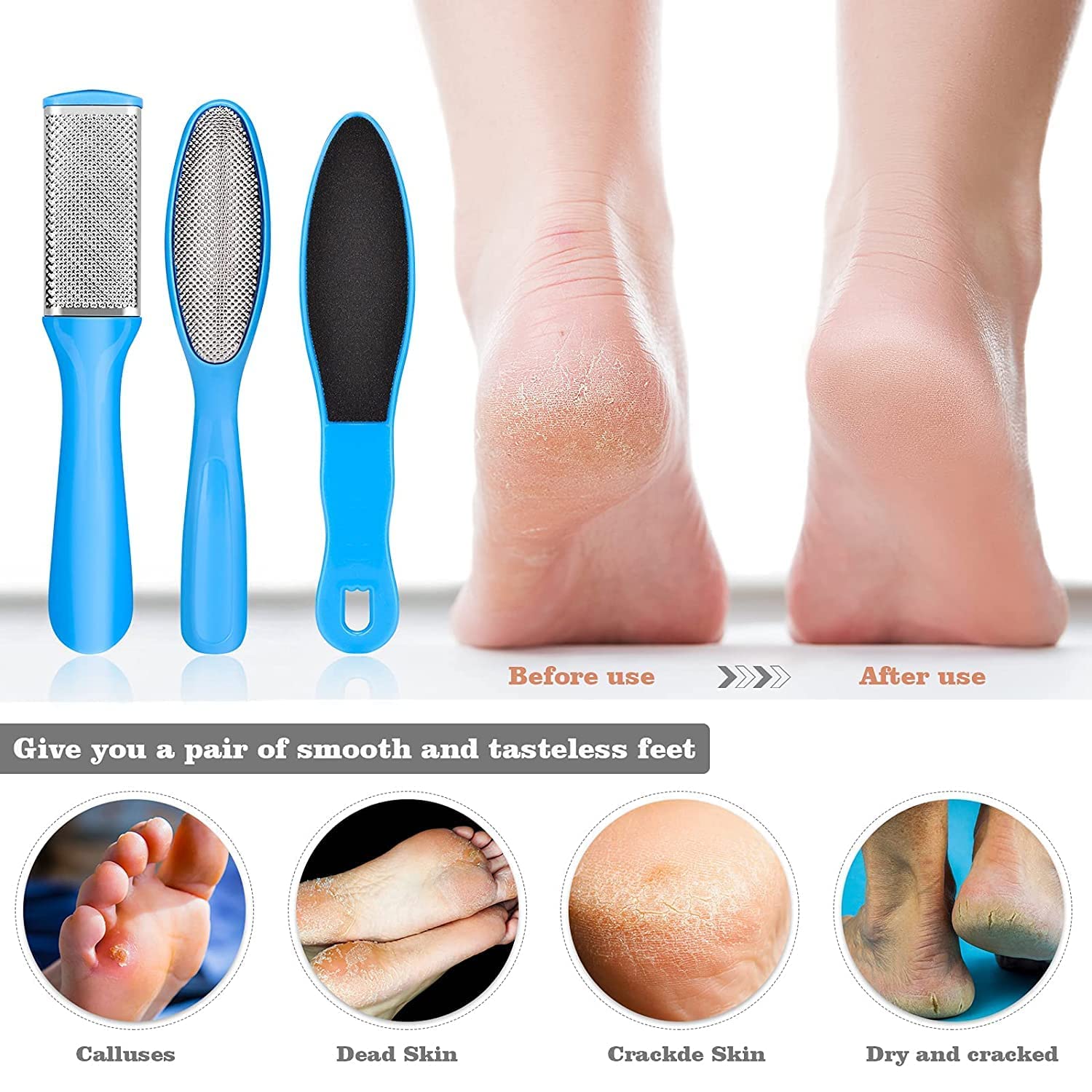 Professional 6-Piece Home Pedicure Kit - Callus Remover, Foot Corn Remover, and Nail File - Effectively Removes Hard, Cracked, and Dead Skin Cells for Soft and Smooth Feet